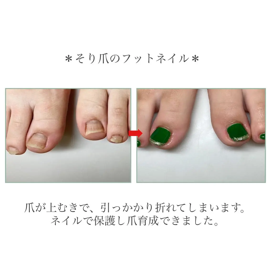 ネイル フットネイル ネイルサロン アリュームのネイルデザイン