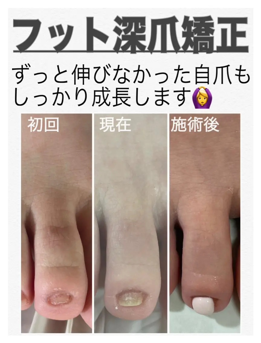 ネイル フットネイル nail salon petillantのネイルデザイン