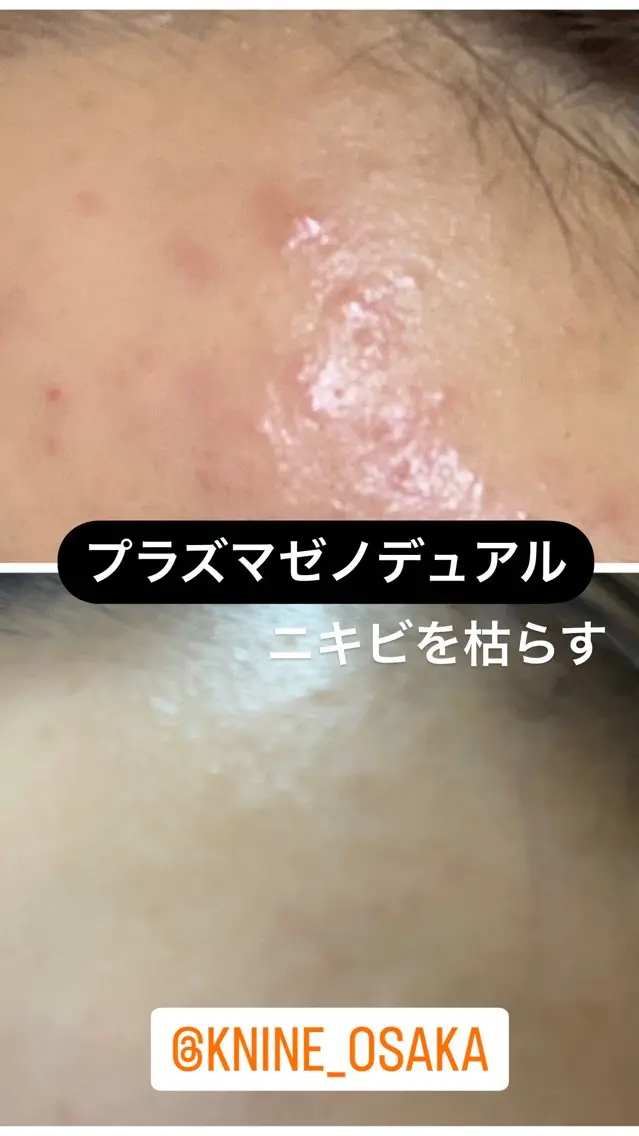 Knine 心斎橋店のエステ・リラクイメージ
