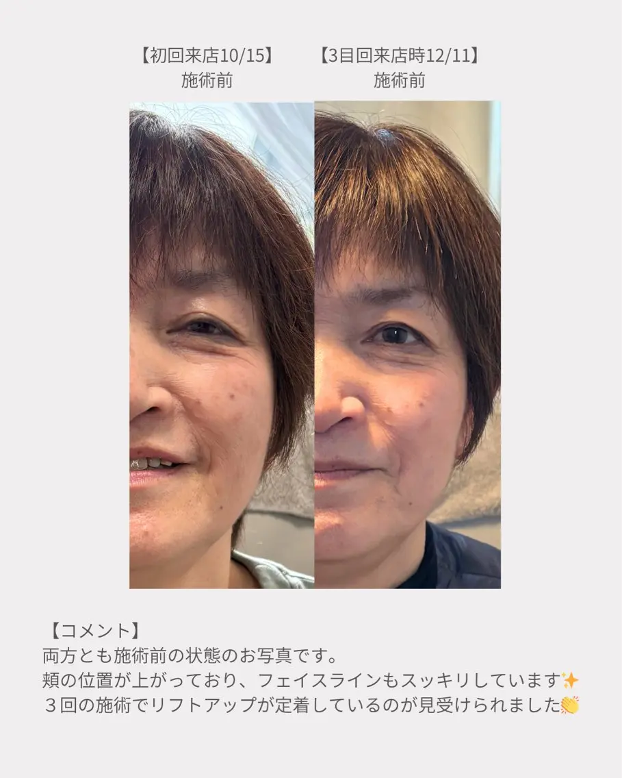 美肌&小顔矯正 Noelieのエステ・リラクイメージ