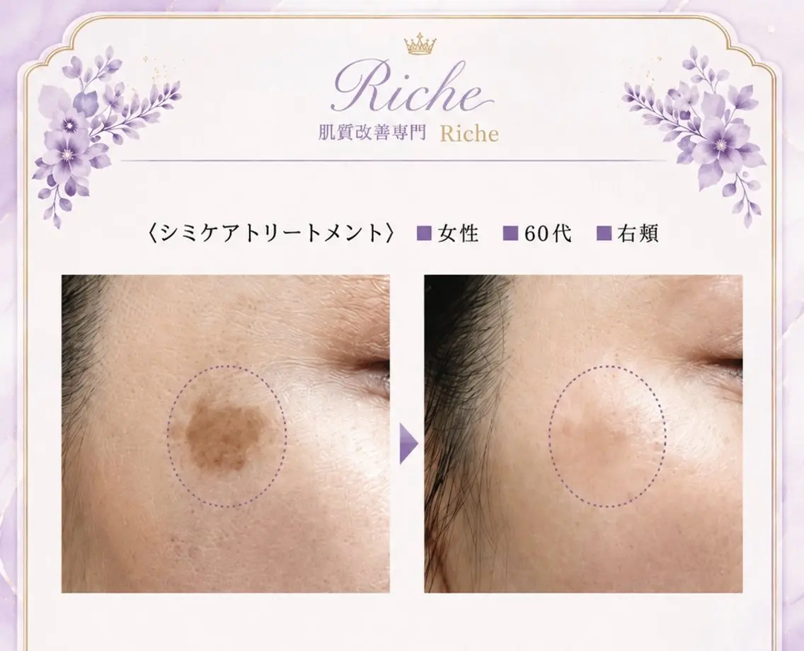 エステ 中摩 美命のエステ・リラクイメージ