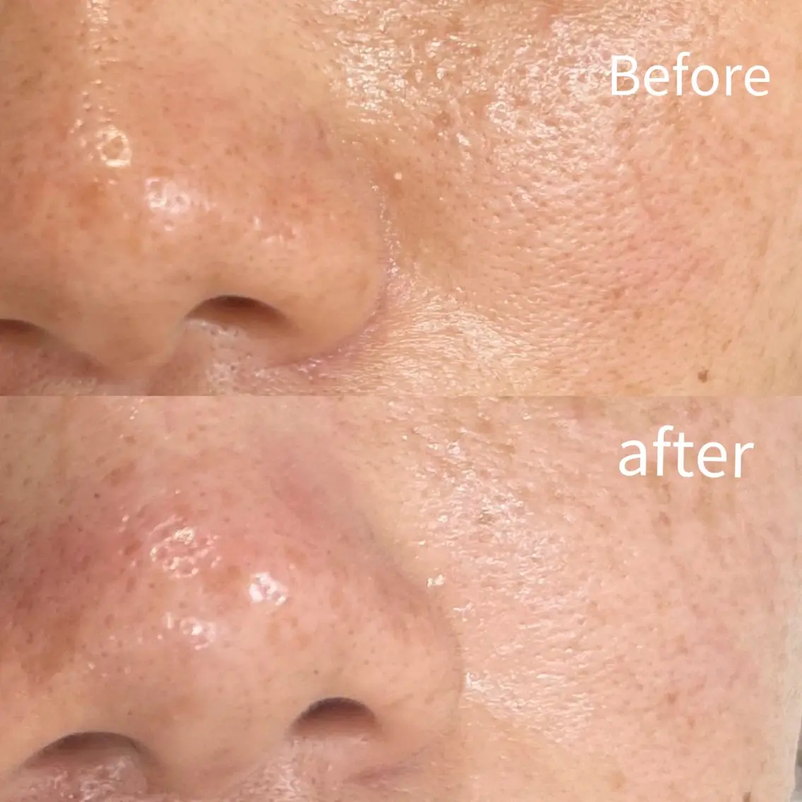 エステ Balance facialのエステ・リラクイメージ