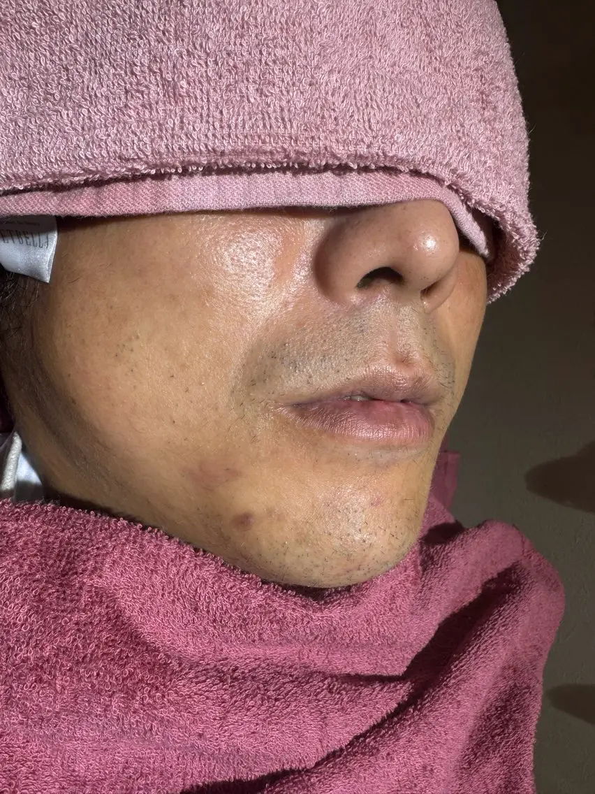 脱毛 下赤塚 ベルミーランドのエステ・リラクイメージ