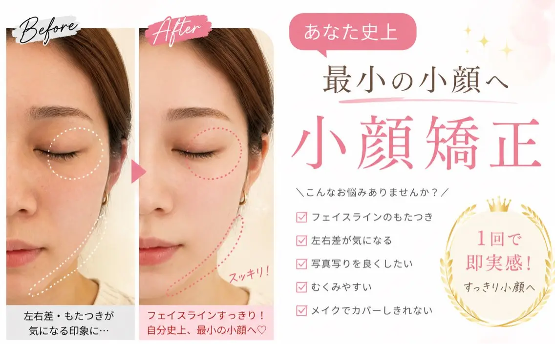 アイドルの様な小顔目指しませんか？小顔矯正の写真