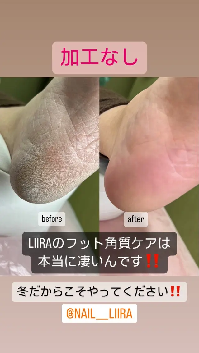 ツルツルふわふわ☺️フット角質ケア🦶✨の写真