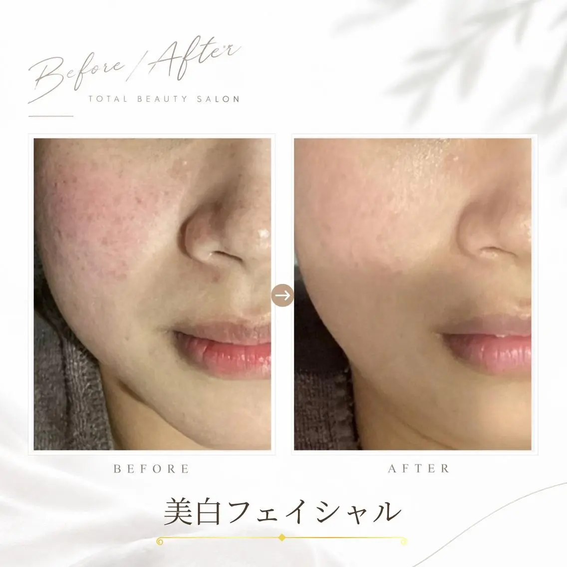 《 肌質×美肌 》 addissimoのエステ・リラクイメージ