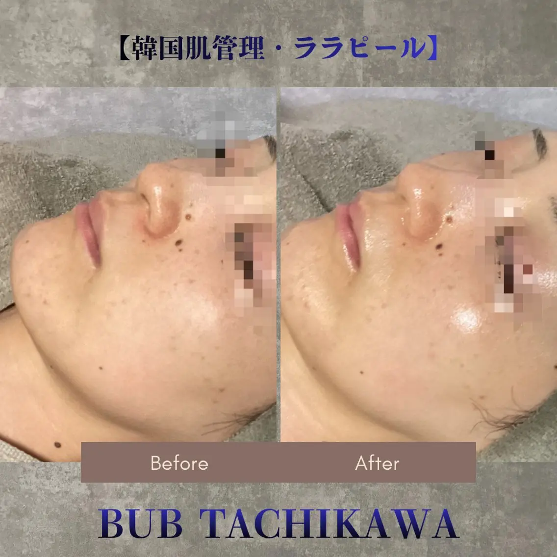 メンズ 【BUB立川】 ゆかのエステ・リラクイメージ