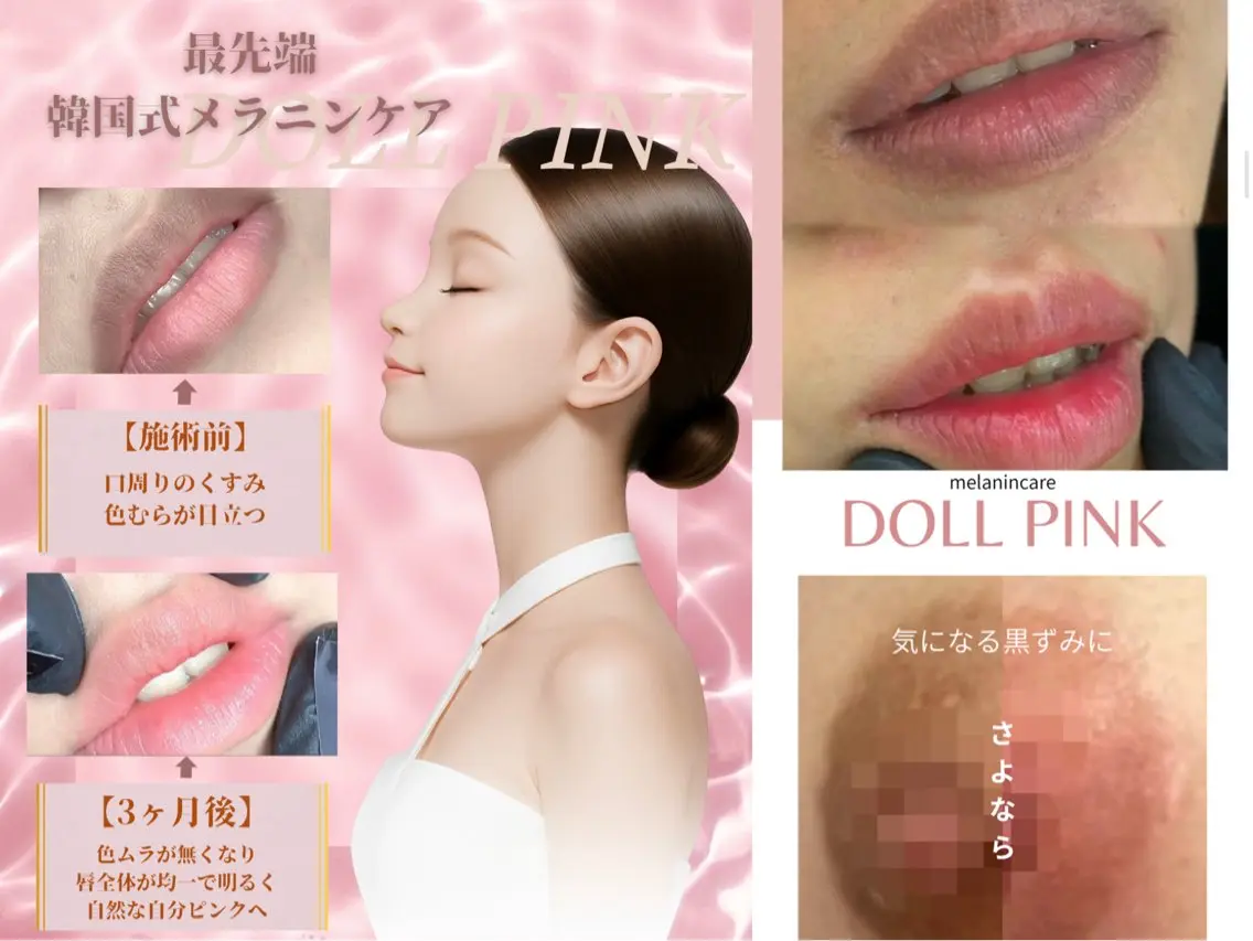 【ドールピンク🩷】カウンセリング無料の写真