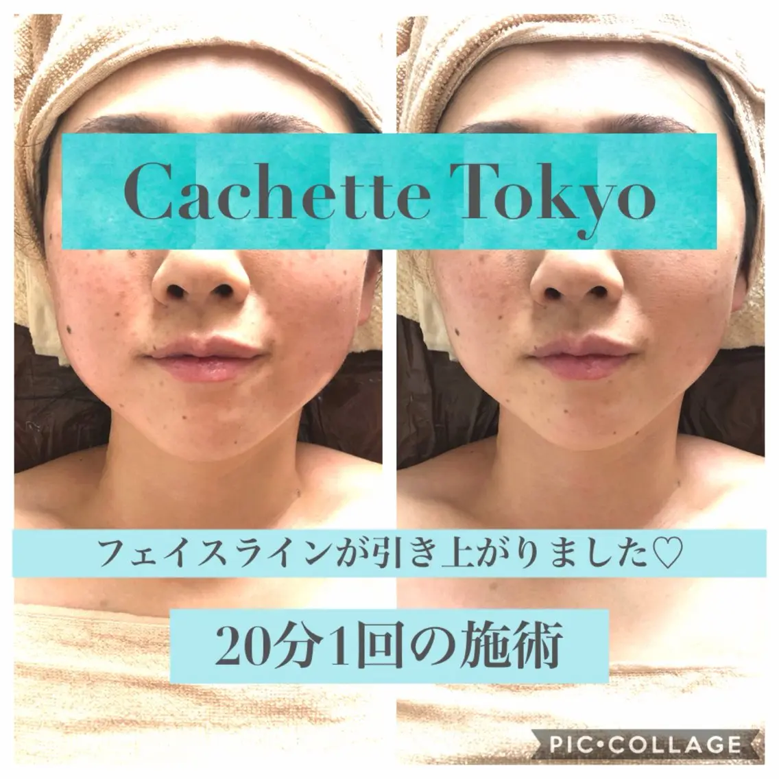 エステ カシェット トーキョーのエステ・リラクイメージ