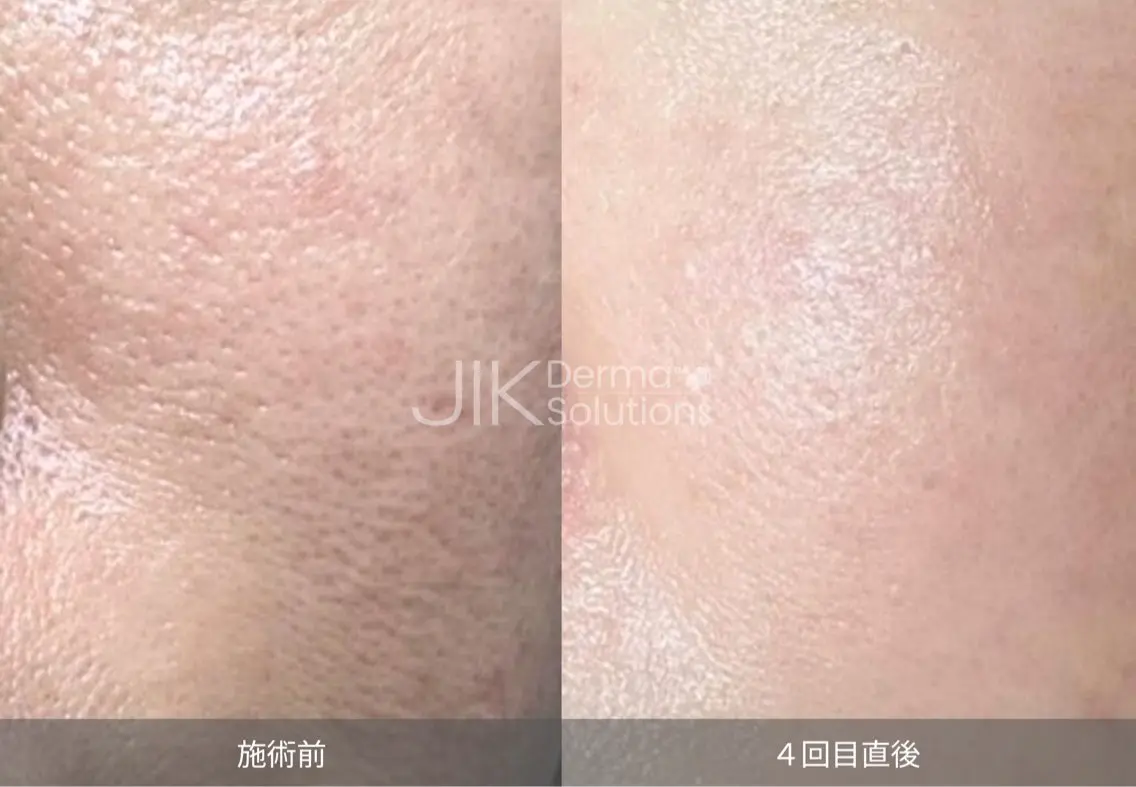 エステ esthesalon O'-en-のエステ・リラクイメージ