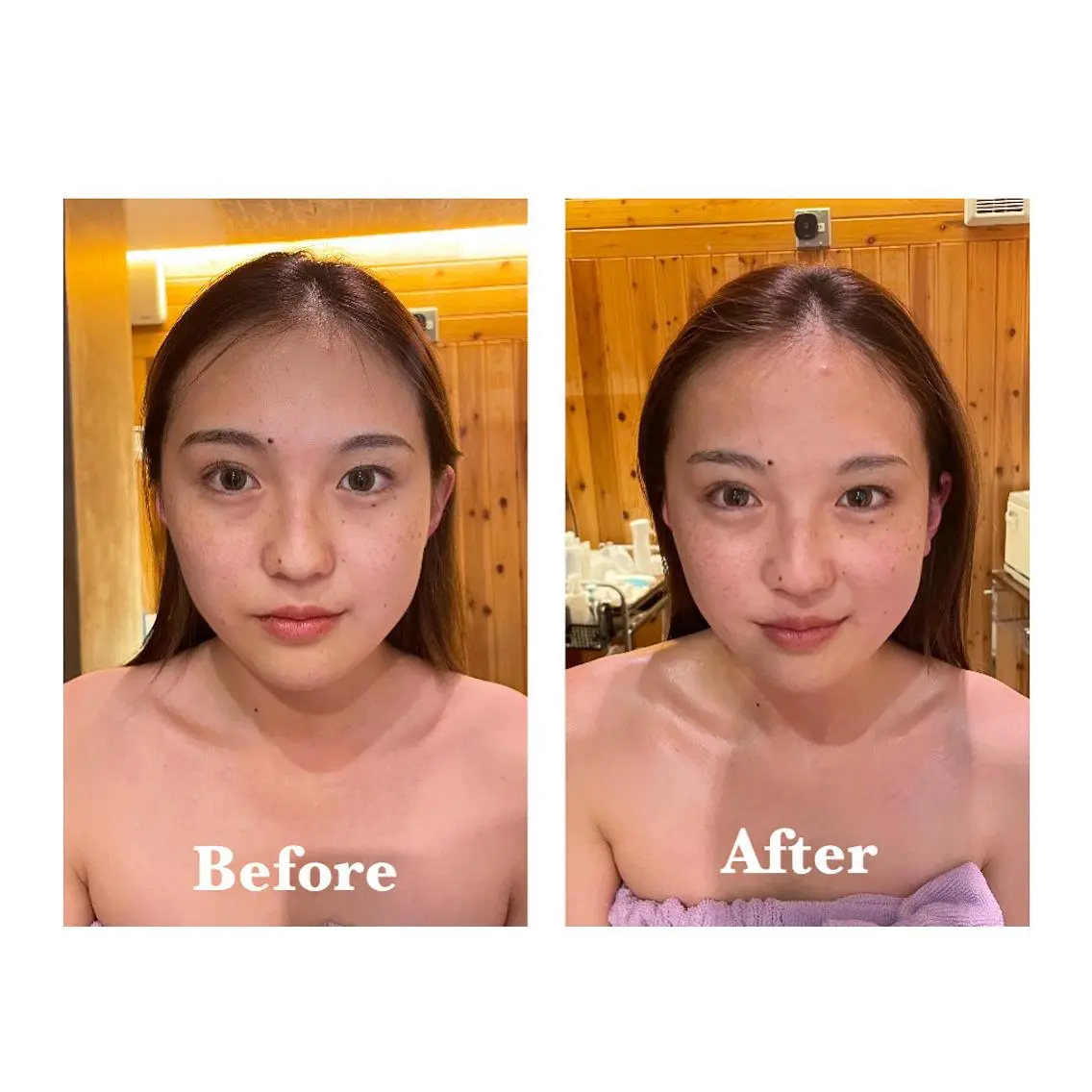 【学生限定】プチフェイシャル🧚🏻‍♀️ 60min 【1回で分かる、本気の肌改善】の写真