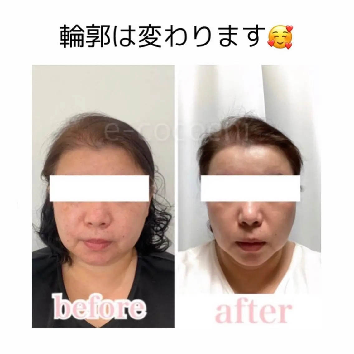 エステ リラク 小顔と ヘッドスパのお店のエステ・リラクイメージ