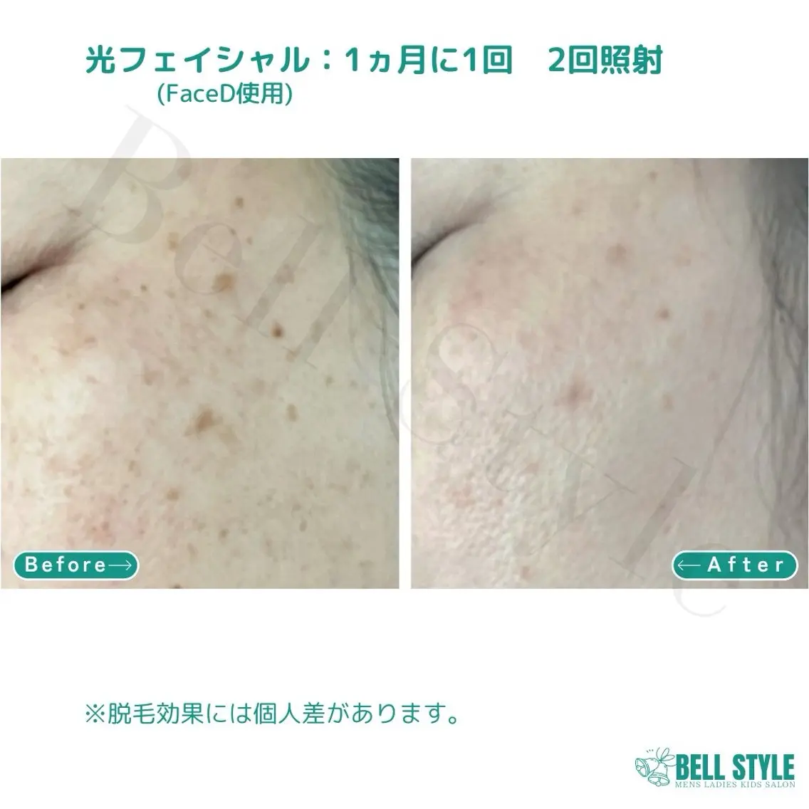 メンズ 【脱毛・美肌専門】 bellstyleのエステ・リラクイメージ