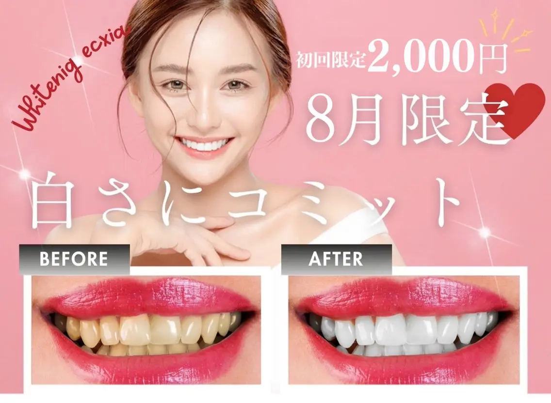 【8月限定🌟エリア最安値!!】強力セルフホワイトニング30分初回体験 ¥7980→¥2000の写真