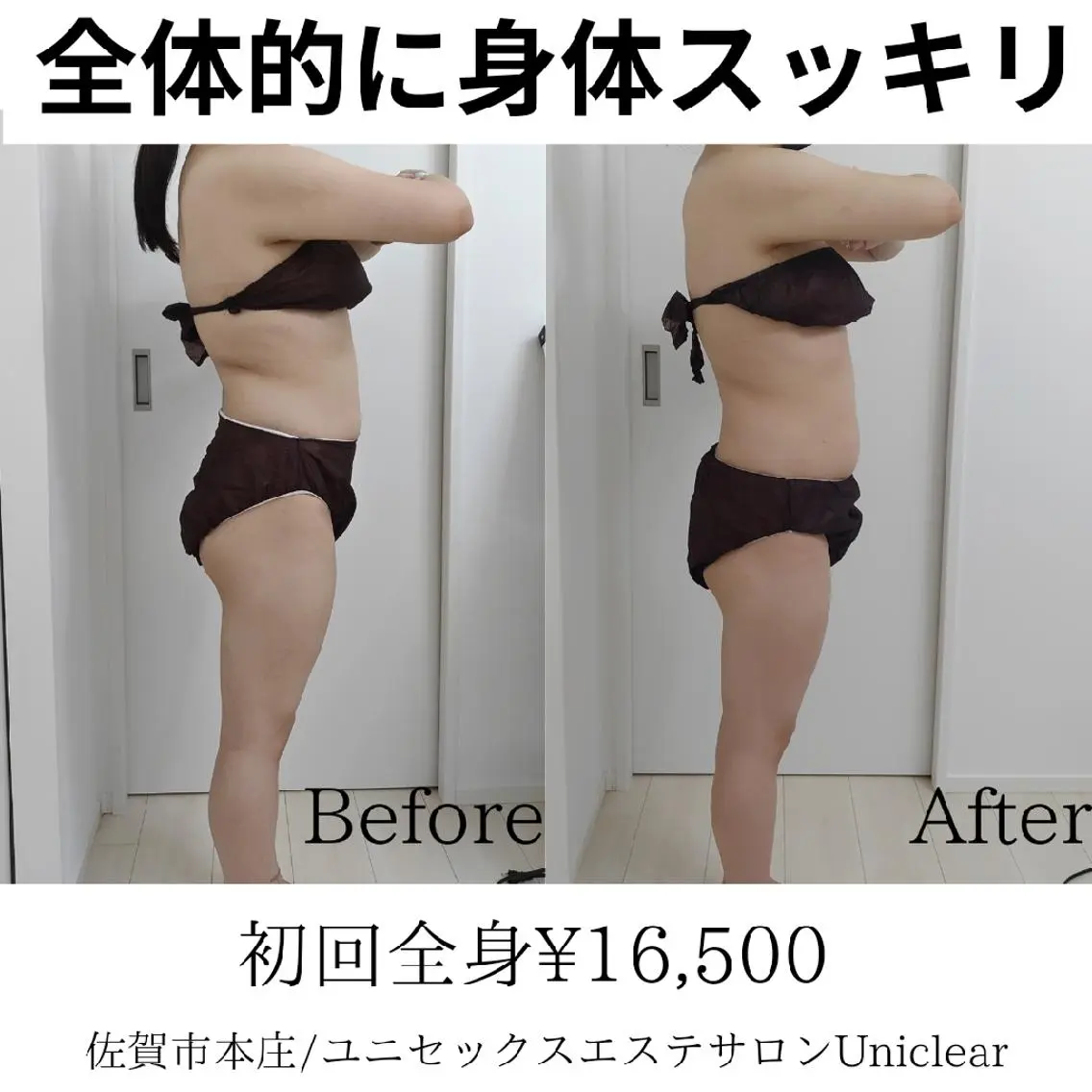 佐賀 痩身・美肌 @uni.clearのエステ・リラクイメージ