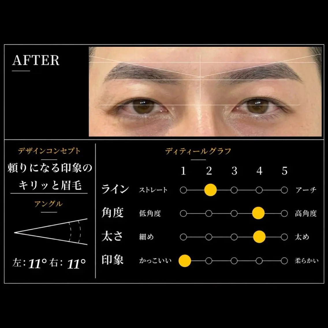 初回限定【口コミ必須】【ミニモ限定】【カリスマサロン】メンズジェントル眉毛脱毛 60分 定価6,500円→3,000円の写真