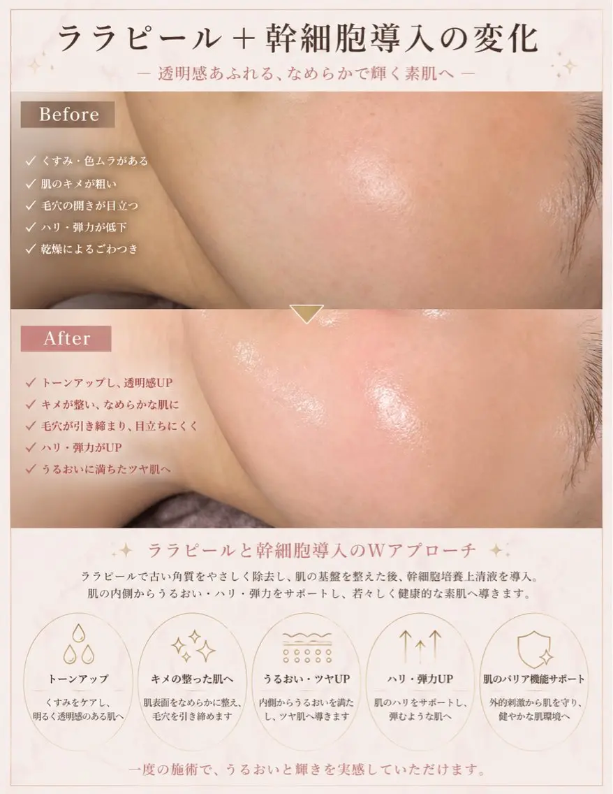 美肌・小顔専門🪄 看護師施術/松﨑のエステ・リラクイメージ