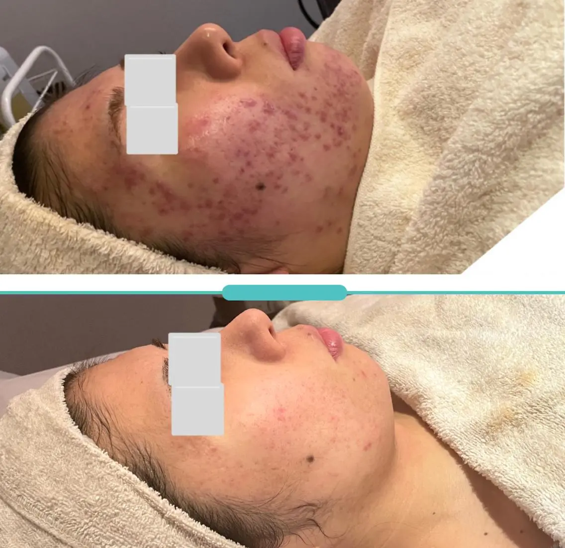 エステ SMOOTH SKIN SPA.のエステ・リラクイメージ
