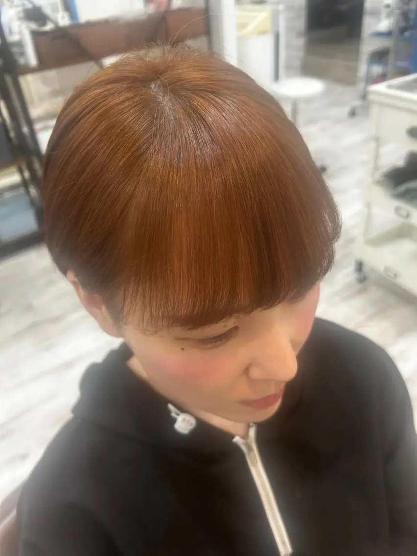 前髪矯正の写真