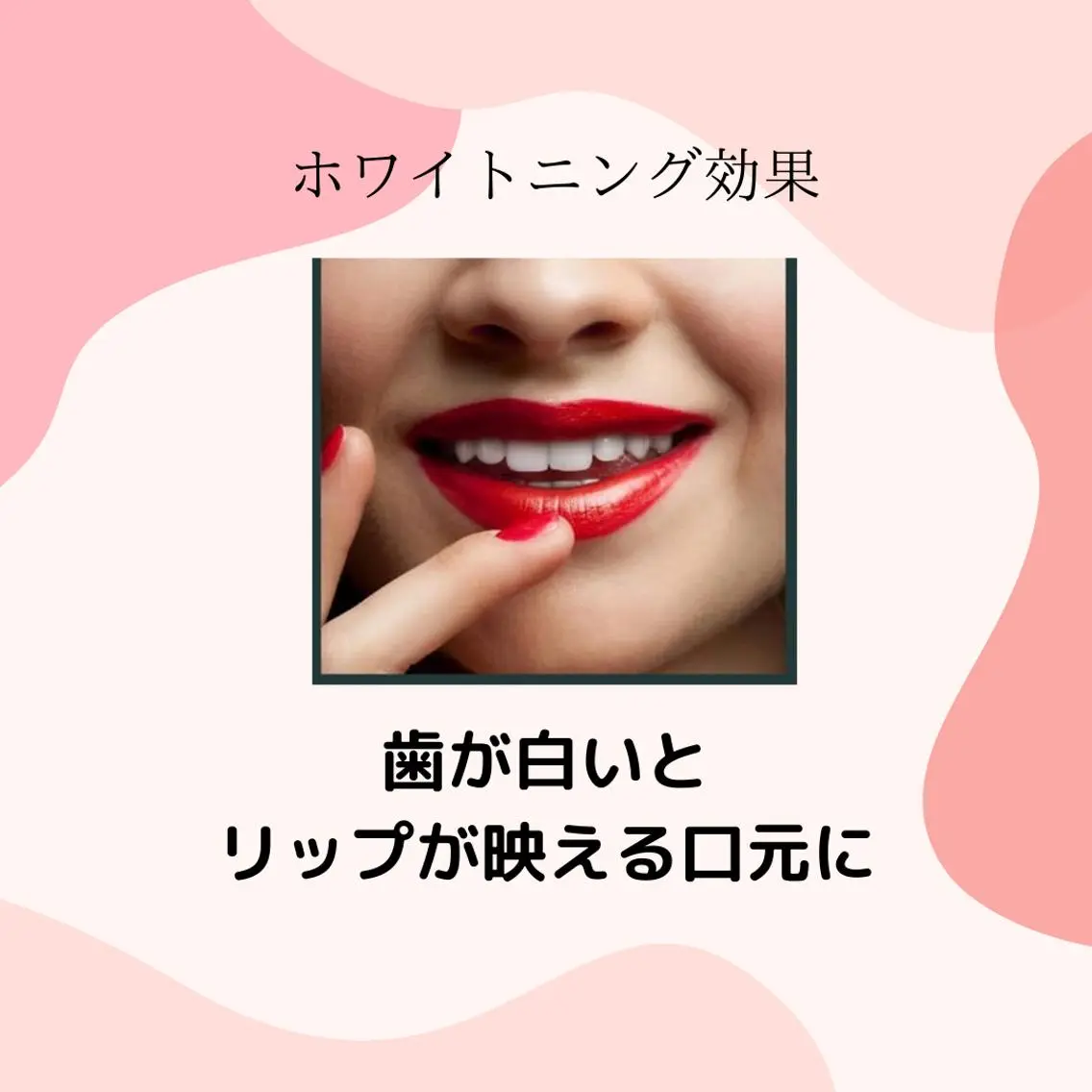 ホワイトニング シャトンのその他イメージ