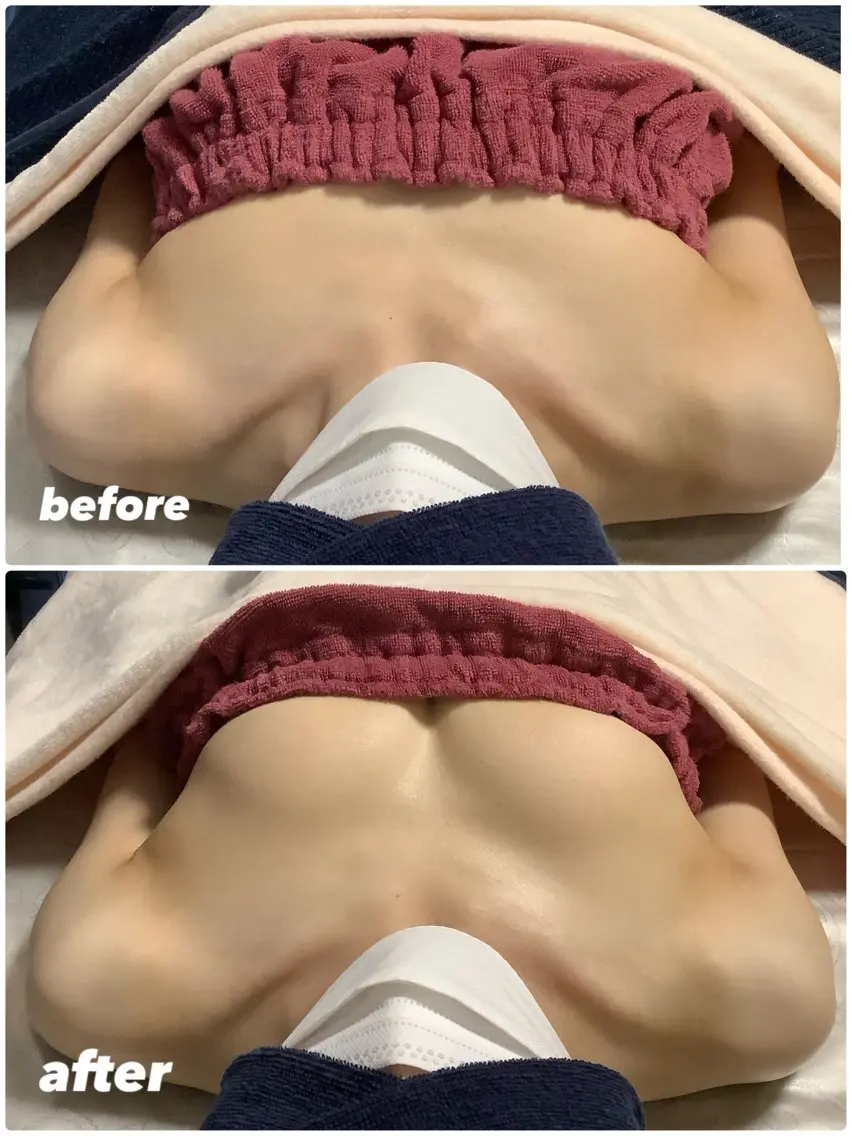 ミラクルバストプレミアムの写真