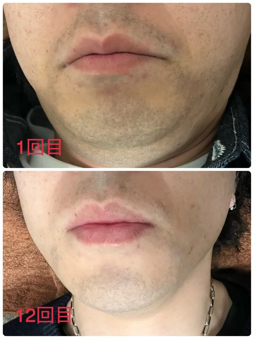 メンズ Mens Salon SOLEのエステ・リラクイメージ