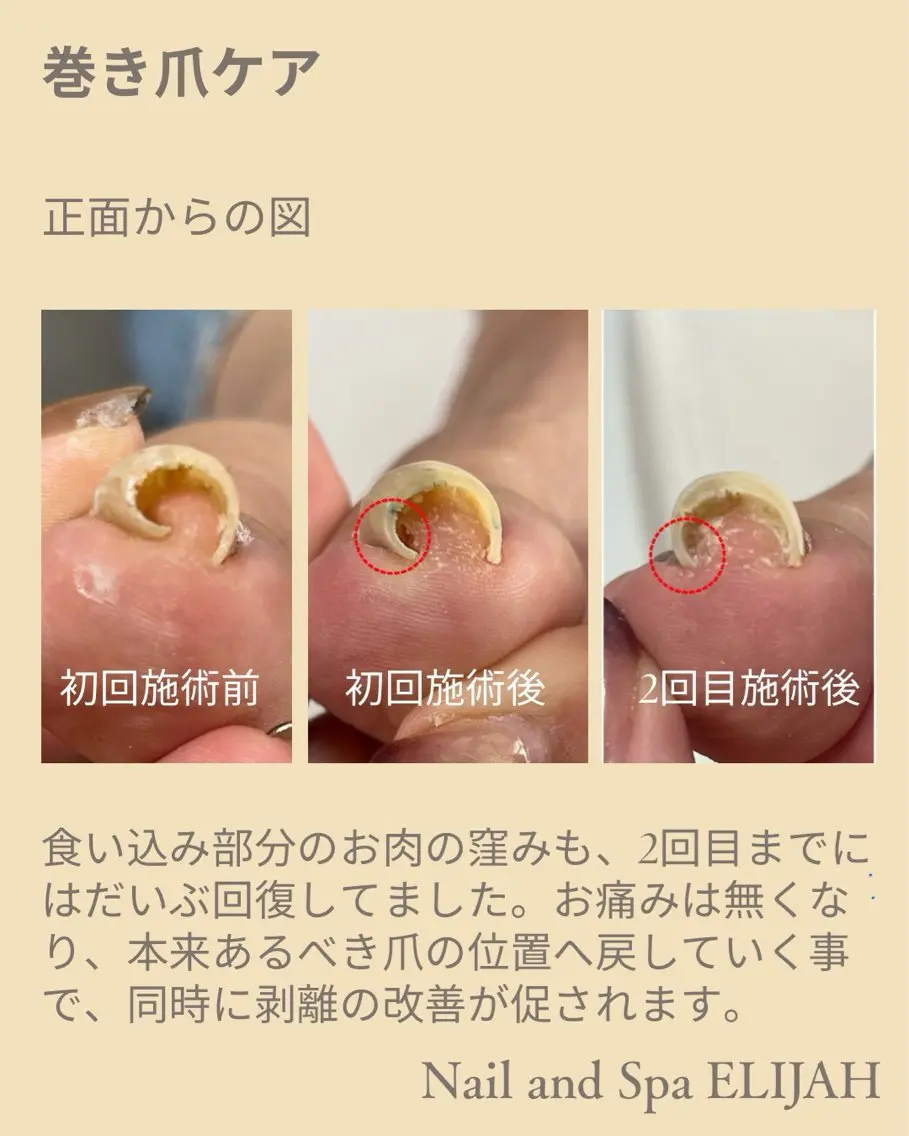 ネイル フットネイル ダンラップ新里 友簣乃のネイルデザイン