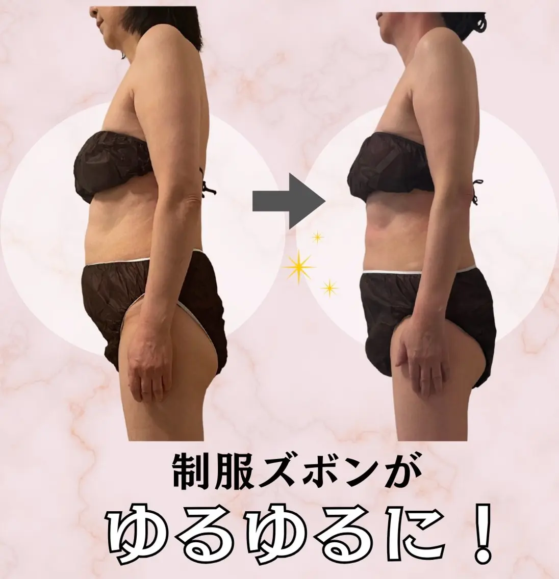 【何しても変わらないお腹】中半身90分 運動や食事だけではケアしにくいお腹・腰周りを理想のボディラインへサポート◎の写真