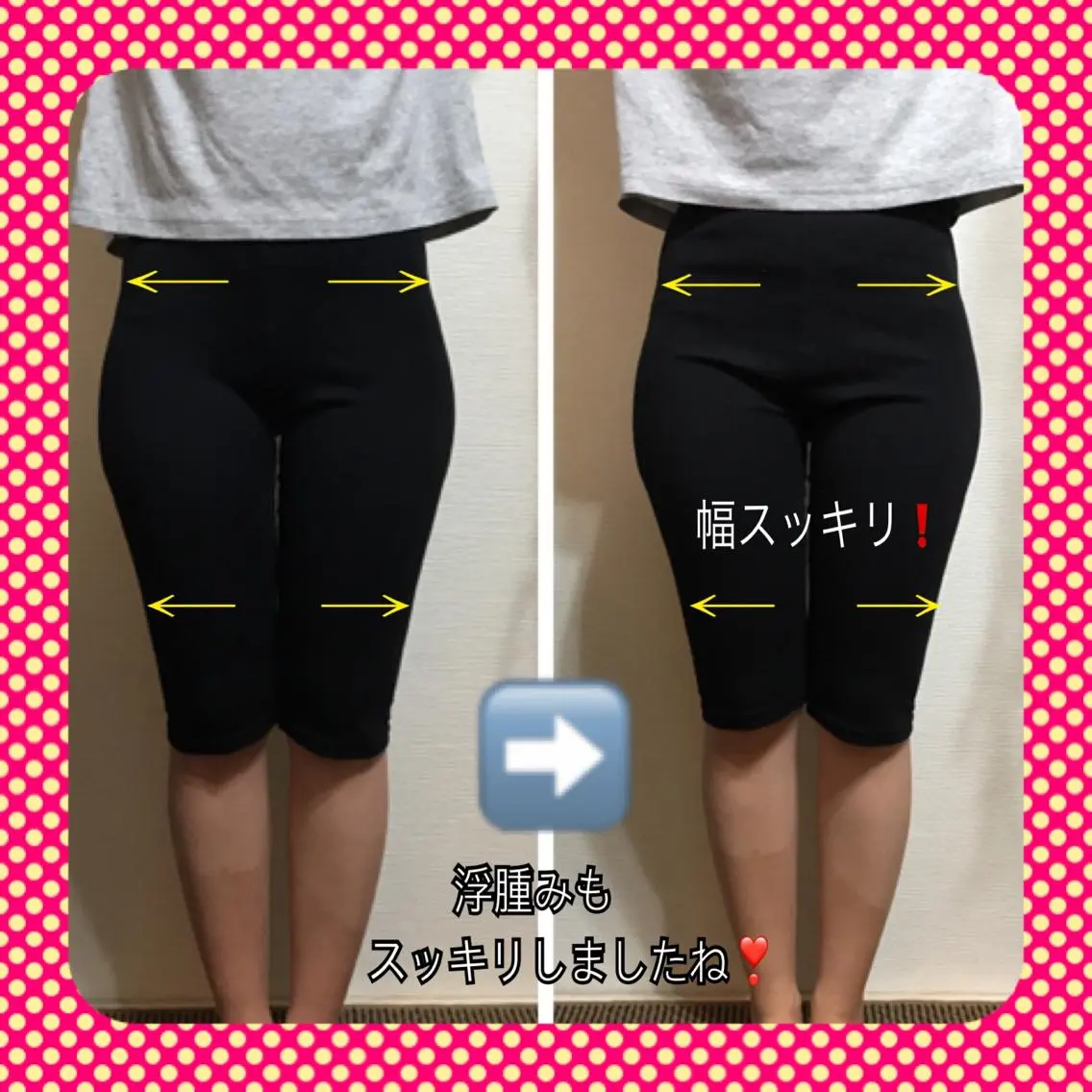 【 骨盤矯正】の写真