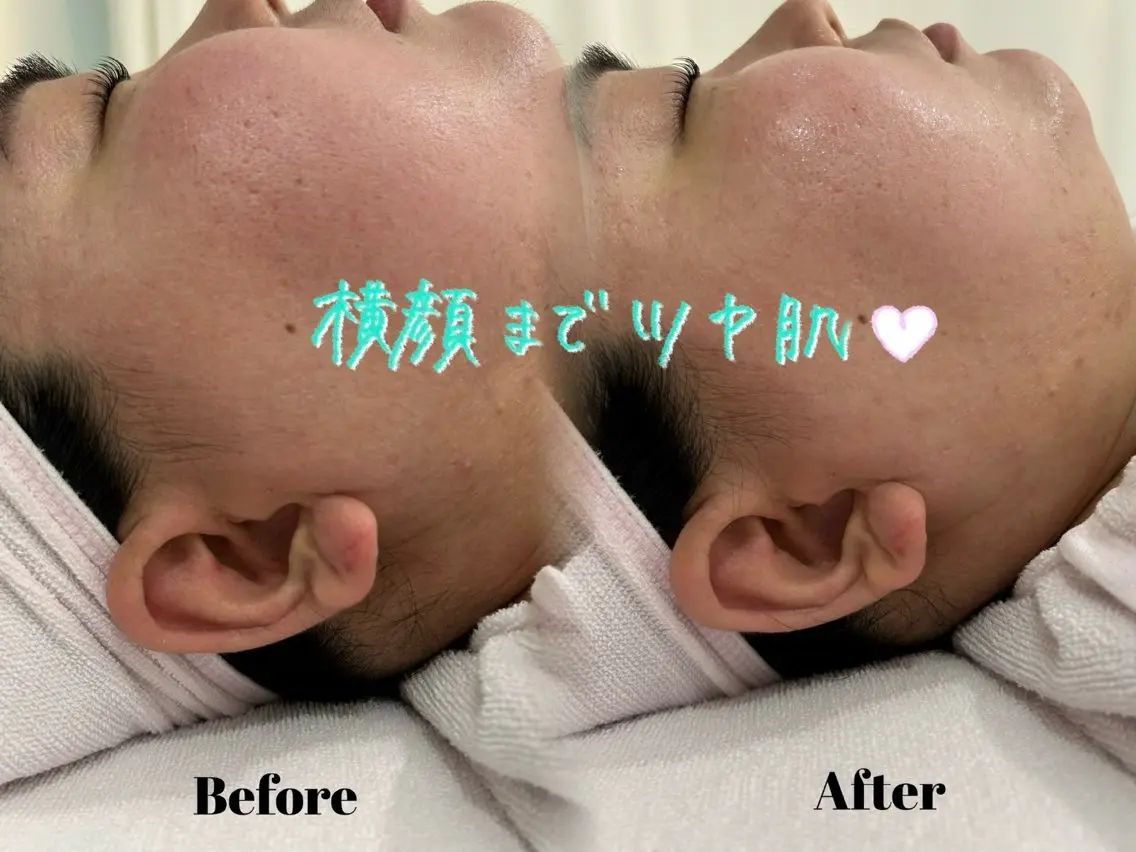 その他 🫧美しい素肌へ🫧 今成柚乃のその他イメージ