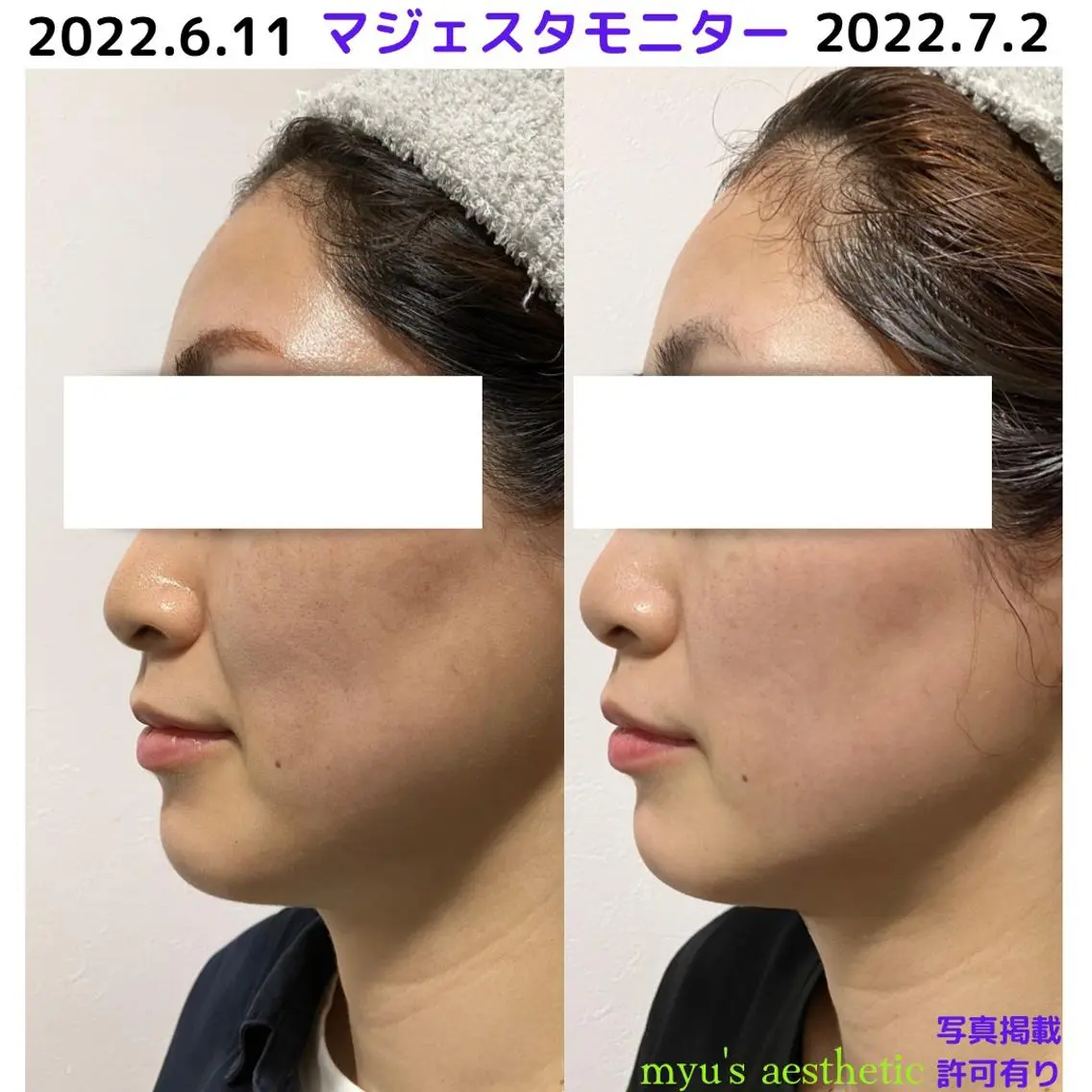 ミューズエステ 谷口美結のエステ・リラクイメージ