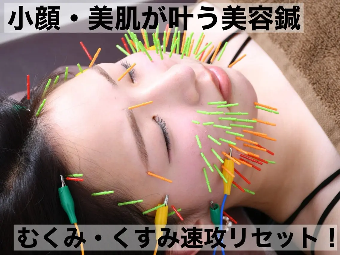エステ リラク 大阪上本町 肌質改善×美容鍼ゆいのエステ・リラクイメージ