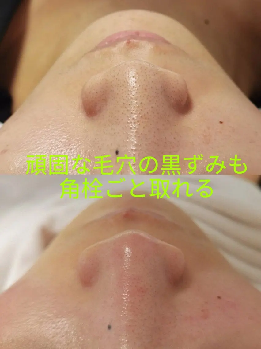 エステ 癒しの郷 サロンのエステ・リラクイメージ