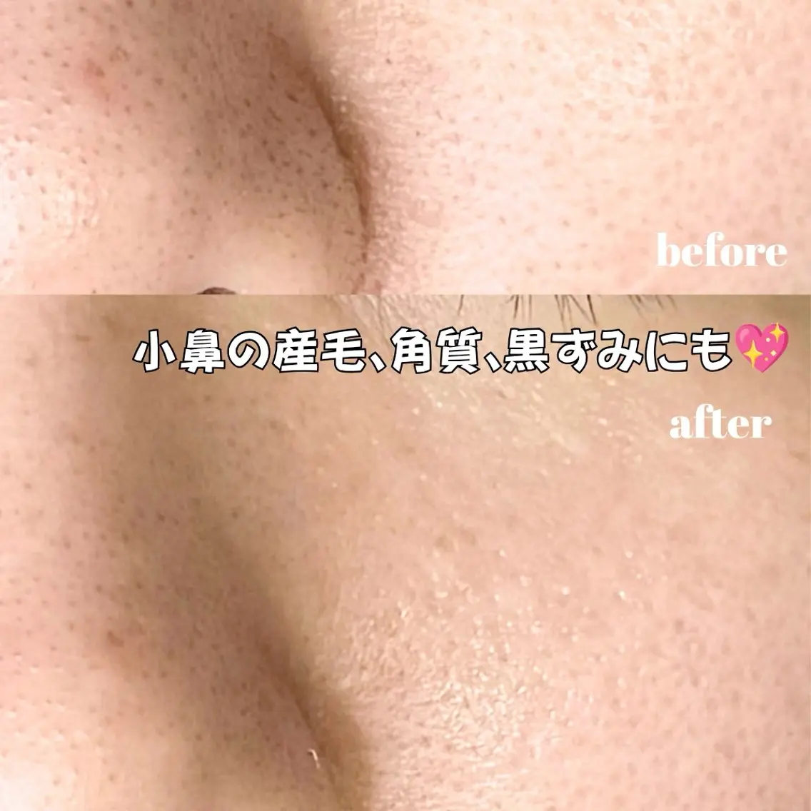 脱毛 eyelash brightのマツエク・マツパデザイン