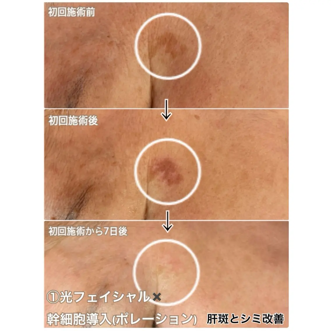 エステ 毛穴と美白の専門店 LAESSE 恵比寿のエステ・リラクイメージ