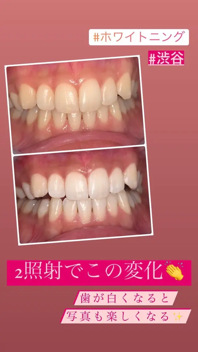 メンズ ラブホワイトニング 池袋店のその他イメージ