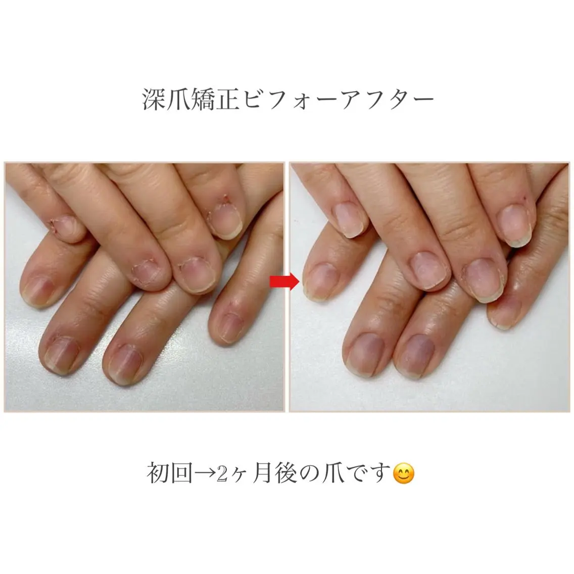 ネイル ネイルサロン アリュームのネイルデザイン