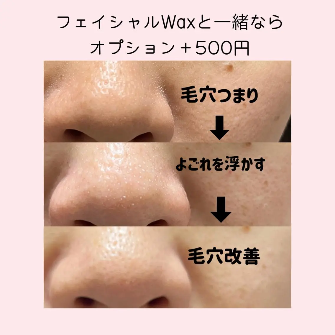 脱毛サロン KiWiのエステ・リラクイメージ