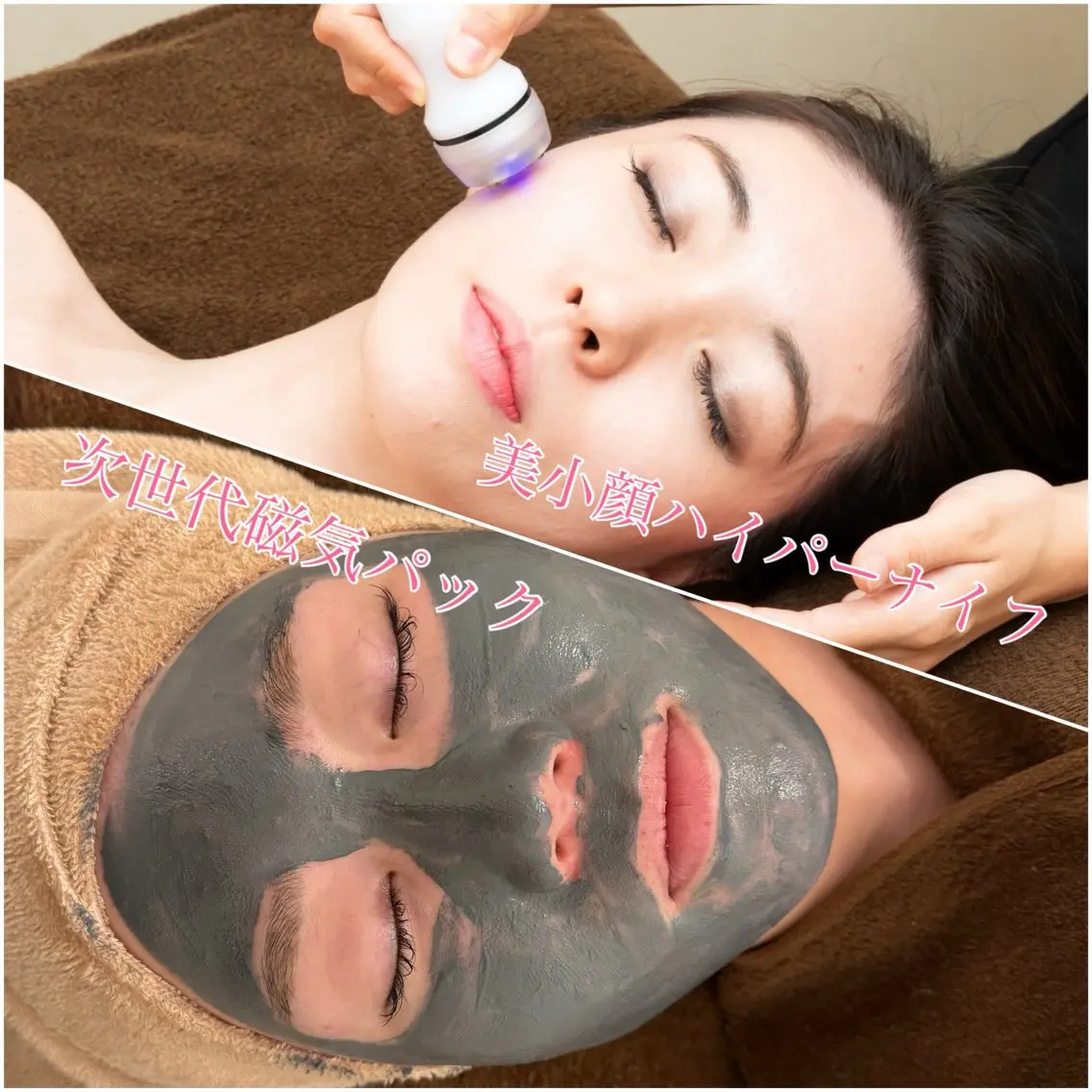 即美白コース！ハイパーナイフフェイシャル+復元パック¥19,800→¥14,800の写真