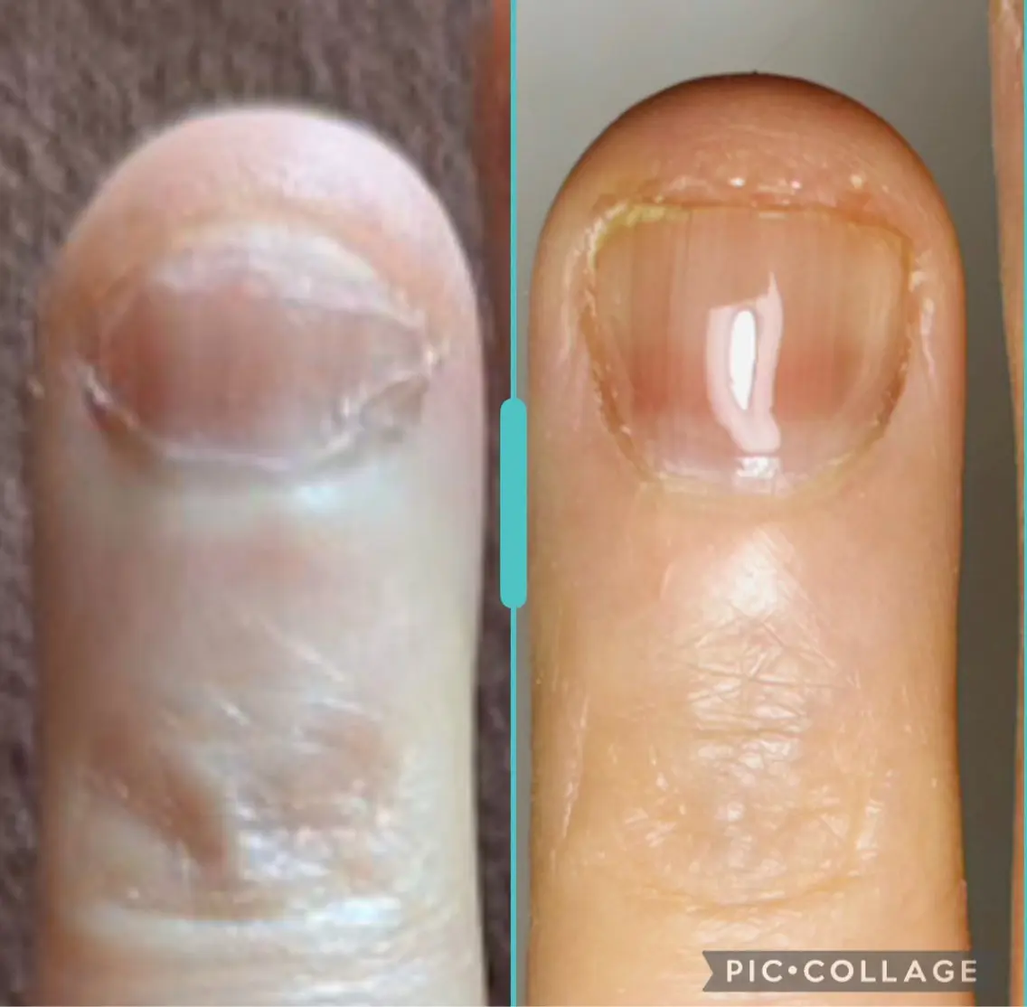 ネイル 深爪・自爪育成専門 MAHALOHIのネイルデザイン