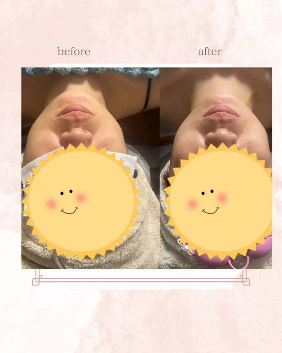 エステ Belle ＋vi（ベル）のその他イメージ