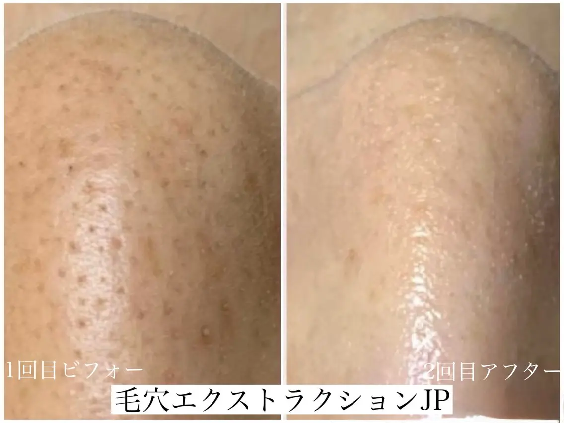 エステ 佐々木 風奈のエステ・リラクイメージ