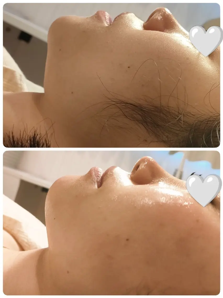 🥀フェイスWax＆鎮静パックの写真