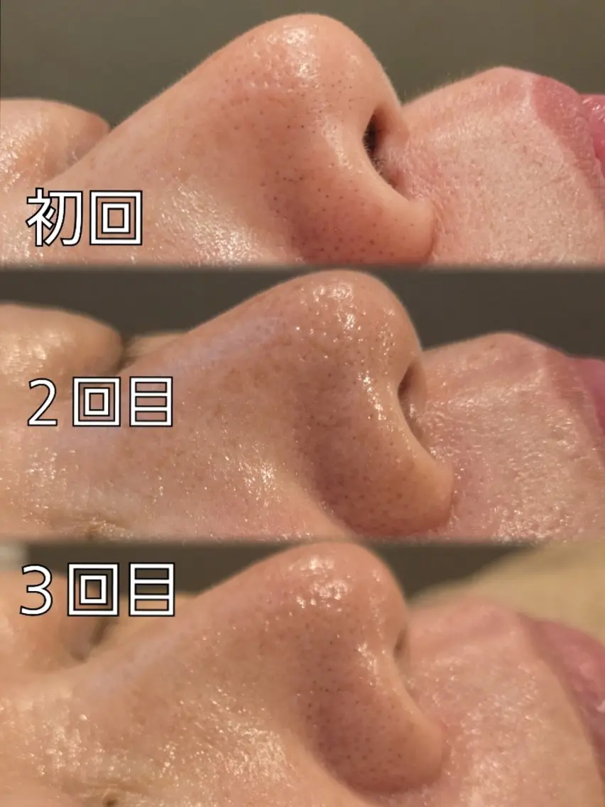 エステ リラク 疲れ・肌の悩みケア ROOT 渡邊のエステ・リラクイメージ