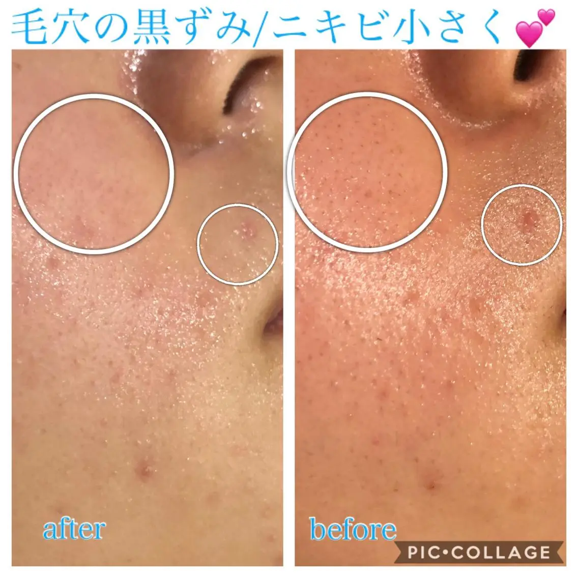 ロング カラー パーマ ヘアアレンジ キッズ ネイル マツエク・マツパ エステ リラク EnsorClair 代表 野口真央のエステ・リラクイメージ