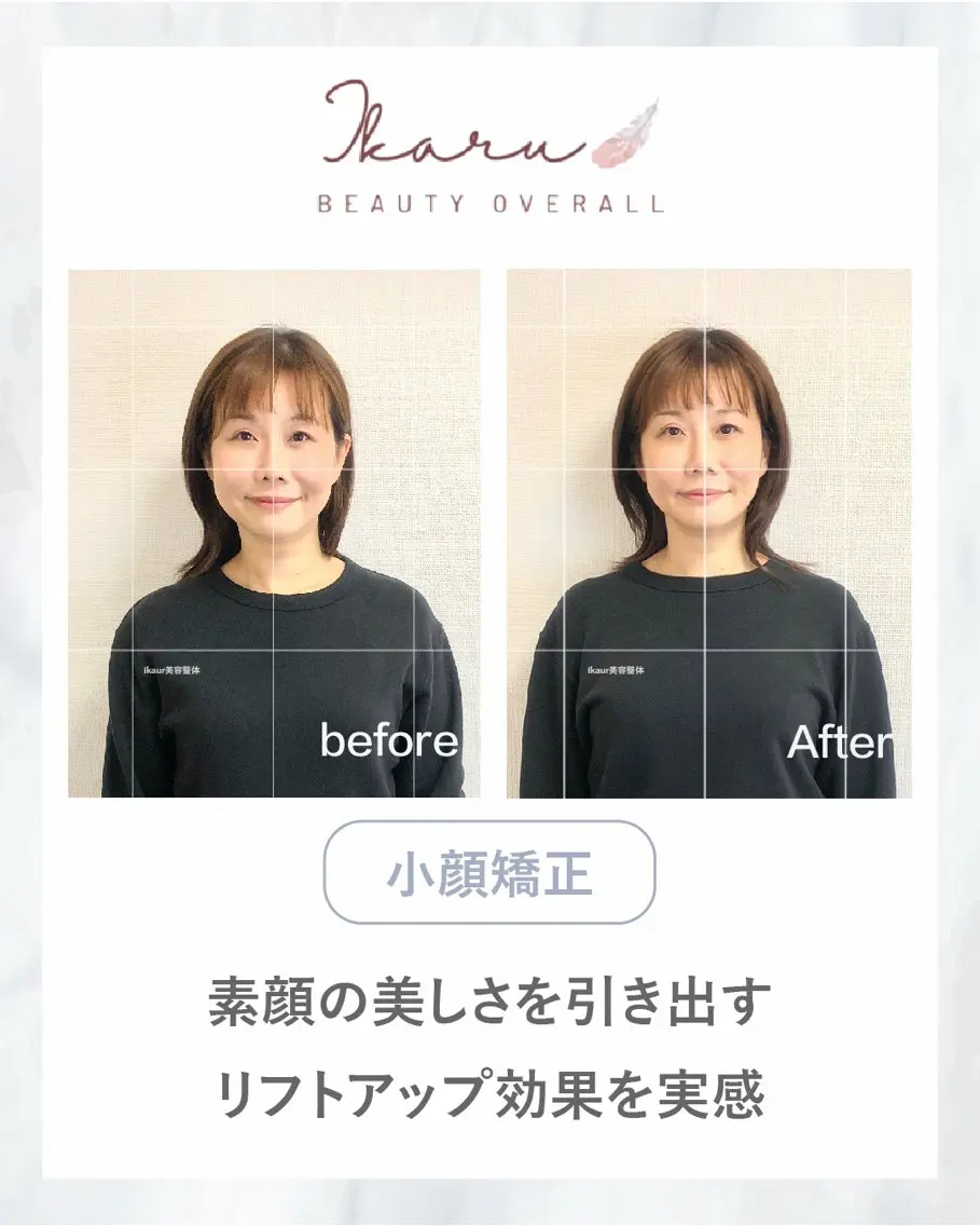 ikaru美容整体| イダのエステ・リラクイメージ