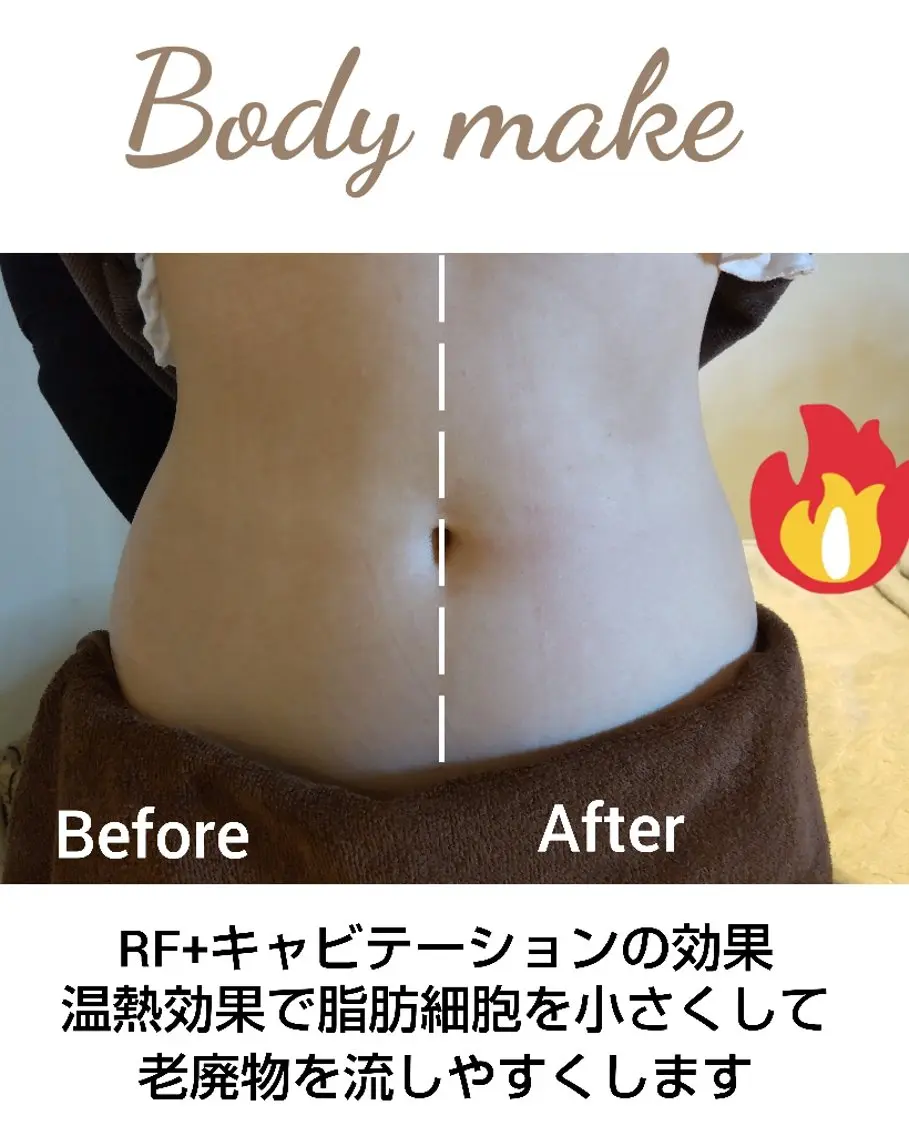 毛穴洗浄・脱毛🌼 痩身🌸嶋津弘美のエステ・リラクイメージ