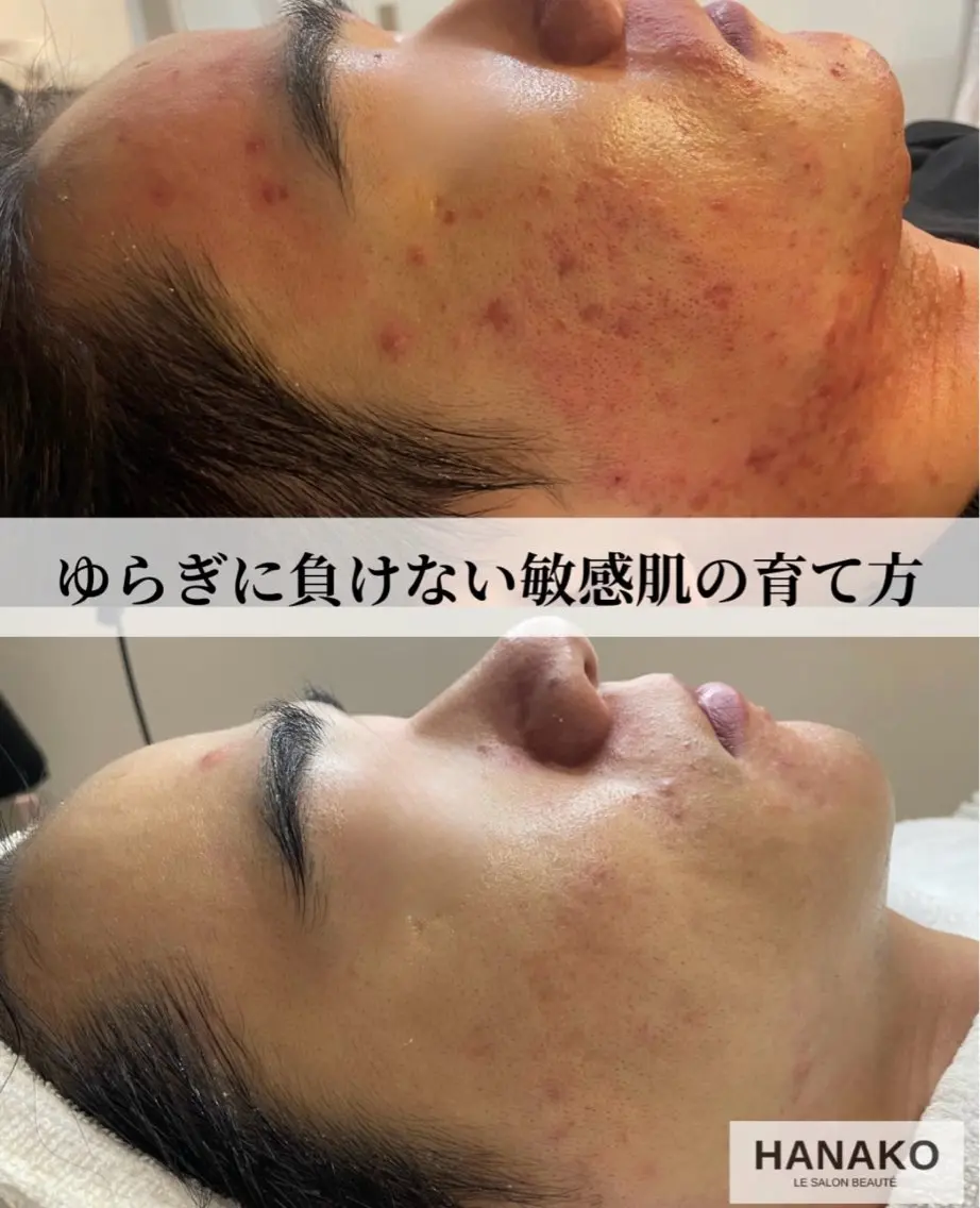 HANAKO 山下のエステ・リラクイメージ