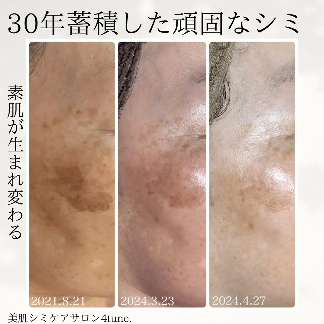 美肌シミケアサロン 4tune.RUMIのその他イメージ