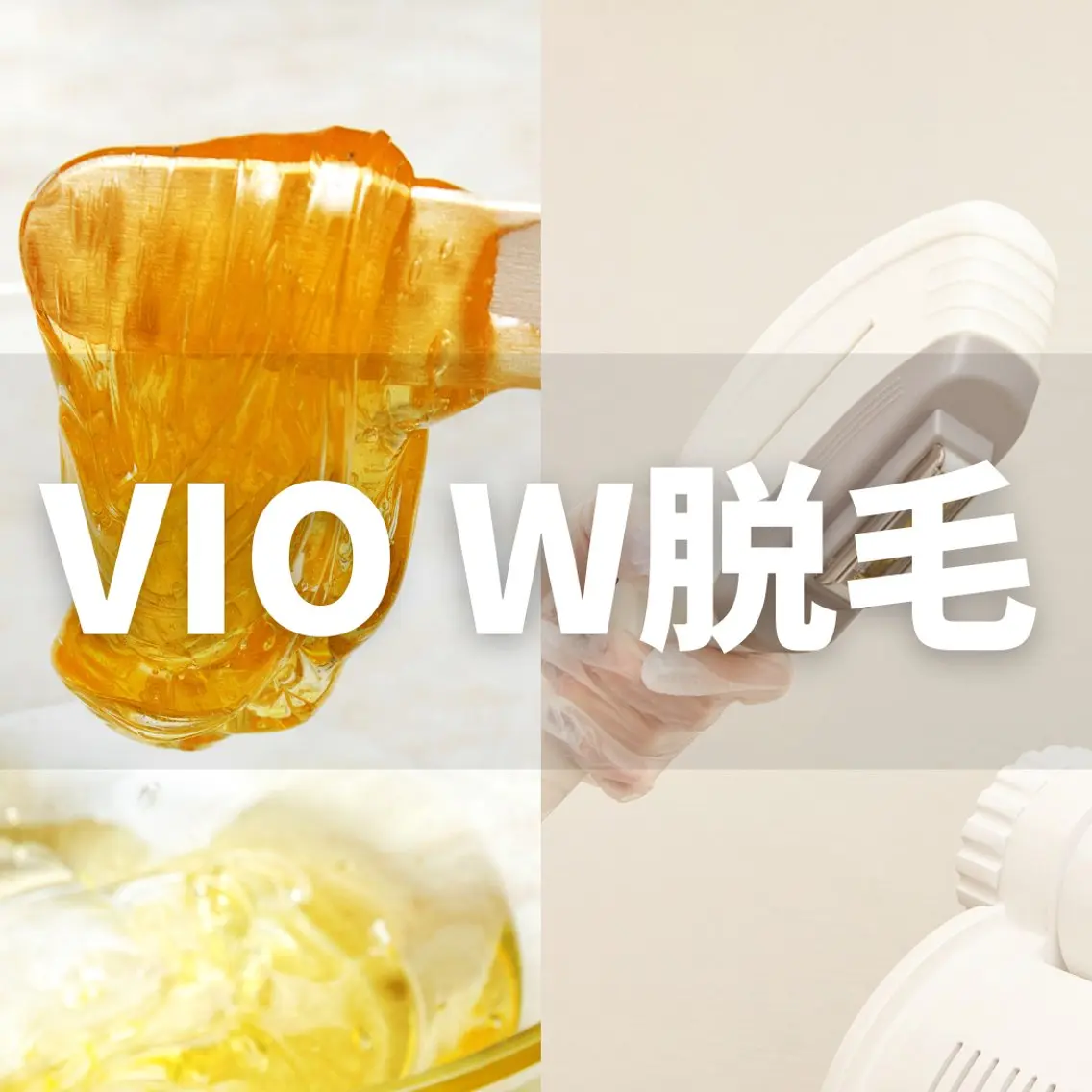 新規💛【VIO】シュガーリング+光脱毛の写真